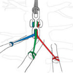 Notch BackBone Knotless Rigging Connector — view 6